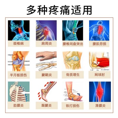 忆林源头厂家批发筋骨通型筋骨通贴代理贴牌图3