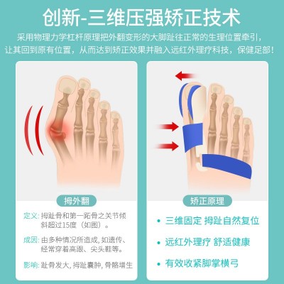 源头工厂三维压强拇外翻矫正器大脚骨脚趾矫形器大拇指分趾器直销图4