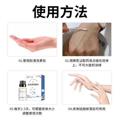 采芝林清疣液体敷料脖子肉粒疣体手指脚趾尖锐疣丝状克疣液现货图5